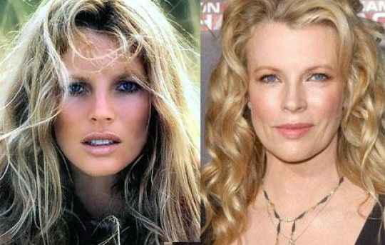 famosos antes y despues