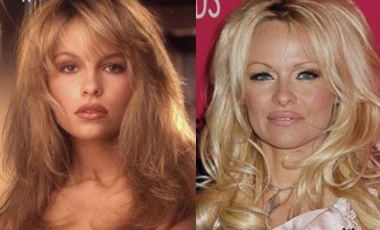 famosos antes y despues