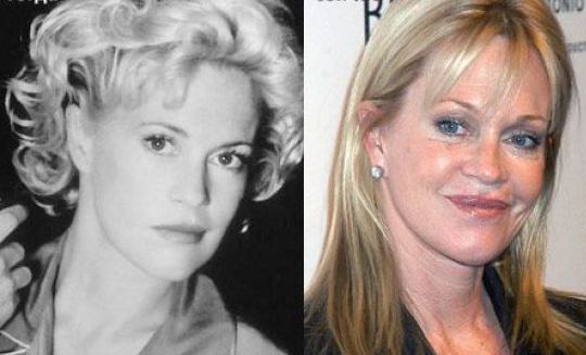 famosos antes y despues