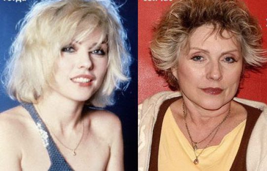 famosos antes y despues