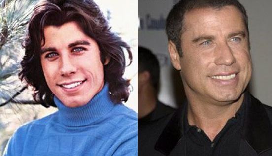 famosos antes y despues