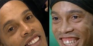 10 Fotos del antes y después de celebridades que pasaron por el dentista